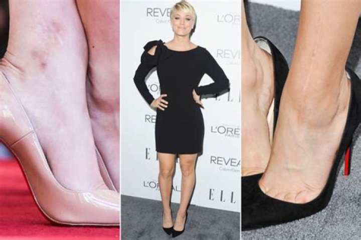 
20 Popular Celebrities and Famous People With Scars 