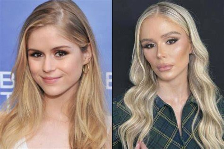 Alanna Panday Plastic Surgery: Before And After Photos