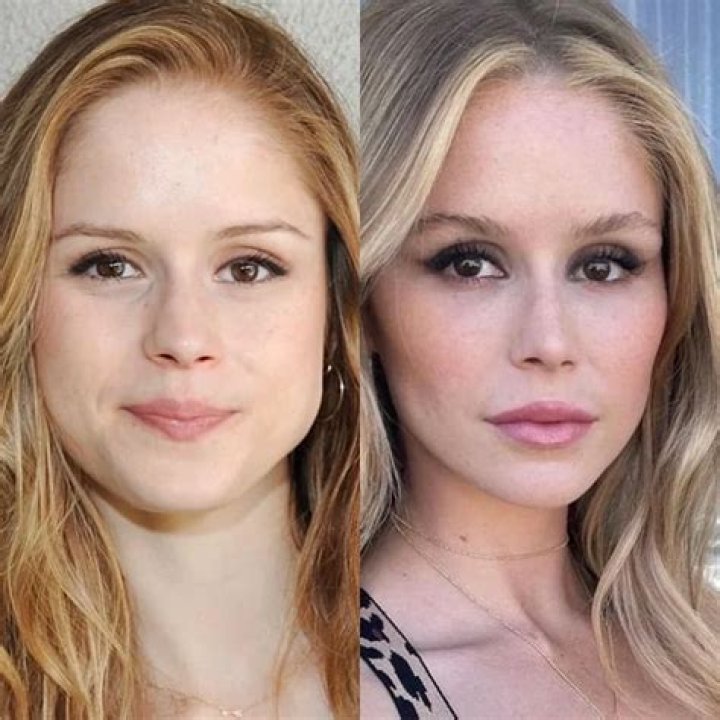 Erin Moriarty Weight Loss Journey And Reasons With Her Before And After Photos