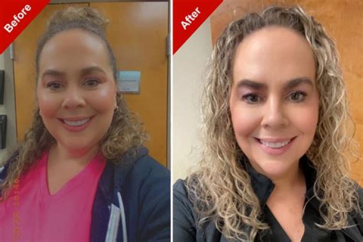 Has Carli Bybel Had A Plastic Surgery? Before And After Photos On IG