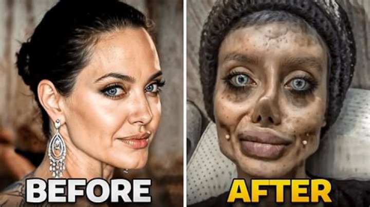 Has Kim Kun Hee Done Plastic Surgery?