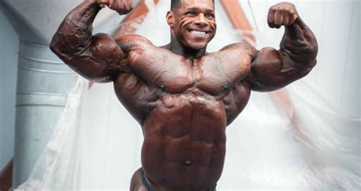 
Is Jessica Feeney Garda Leaving Bodybuilding? Personal Injury Claims After A Video 