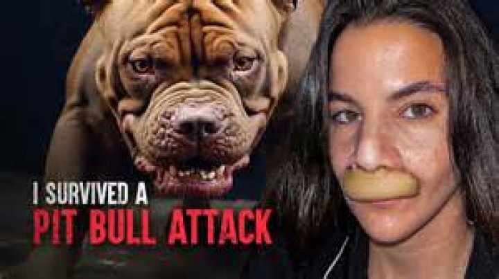 
North Carolina woman loses foot in horrific pit bull attack 