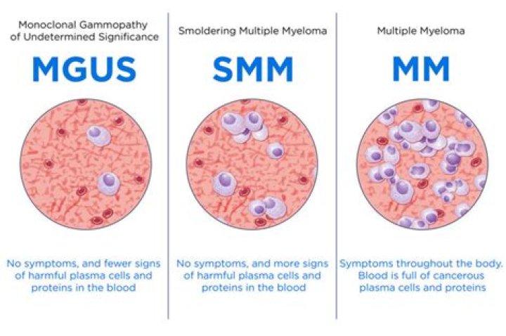 
Steve Scalise health: Multiple Myeloma treatment, symptoms, cause, hereditary and more 