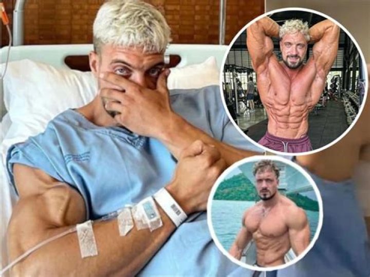 
What causes an aneurysm? Jo Lindner cause of death and symptoms explored as bodybuilder dies aged 30 