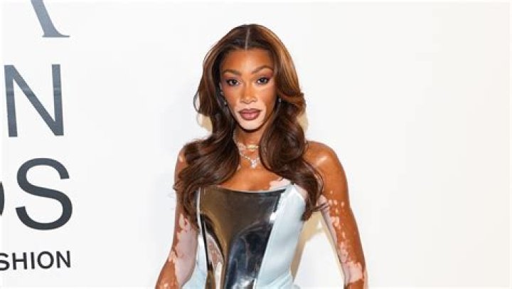 Winnie Harlow Height, Weight, Net Worth, Age, Birthday, Wikipedia, Who, Nationality, Biography